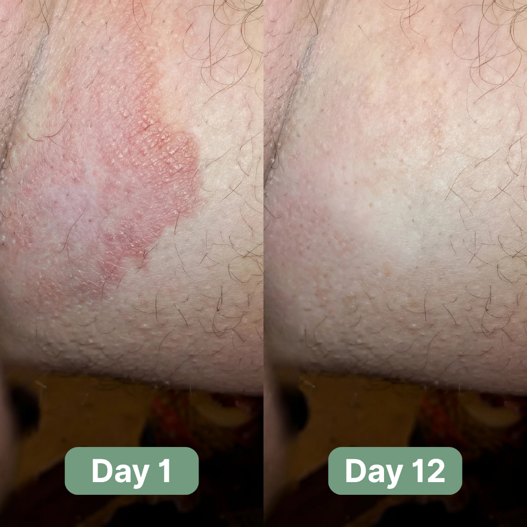 Cleriva Sapone Antifungino®